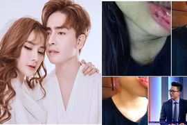 MC Minh Tiệp bị tố bạo hành em vợ suốt 5 năm