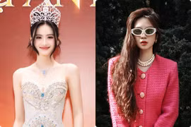 Hot face sao Việt: Ý Nhi được khen nhuận sắc sau “dao kéo“