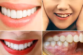 Nhìn tướng răng, đoán ngay vận mệnh tương lai giàu nghèo 
