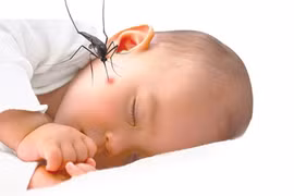 Cách xử trí khi trẻ bị côn trùng đốt
