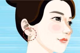 Gallery - Bói Nốt Ruồi - image 11