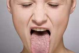 Phương pháp chữa khó nuốt dễ dàng sau điều trị ung thư