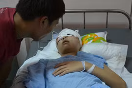 Trốn công an, 2 thanh niên gặp TNGT nguy kịch