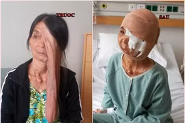 Người đàn bà “mặt quỷ” đã được cứu