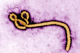 Phát hiện mới về loại virus khiến 25-90% người nhiễm bệnh tử vong