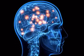 Chàng trai 19 tuổi mắc Alzheimer: Bác sĩ nói gì?