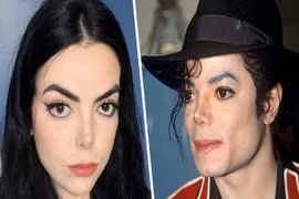 Sửng sốt với cô gái có khuôn mặt giống Michael Jackson