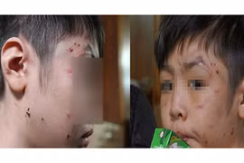 Những đứa trẻ lớn lên trong bạo hành sẽ ra sao khi lớn lên?
