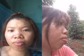 Cô gái từng bị chồng bỏ vì xấu như Thị Nở