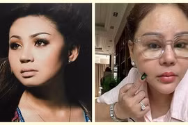 Lê Giang phủ nhận tiêm filler “méo mặt”, từng mê dao kéo thế nào?