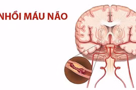 Gallery - BỆNH THƯỜNG GẶP - image 11