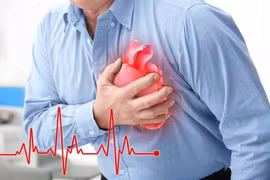 Cơn đau ngực do thiếu máu cơ tim: Cách nhận biết và giảm đau hiệu quả