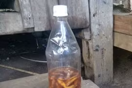 Gallery - Ngộ Độc Rượu Methanol - image 11