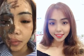 Gallery - Cựu thiếu úy công an tạt axit vợ sắp cưới - image 5