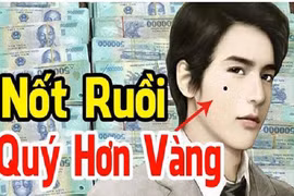 Nốt ruồi “ngàn vàng khó mua”, ai sở hữu thì giàu sang 1 đời