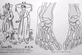 Biết gì về “bàn chân Giao Chỉ” của người Việt cổ?