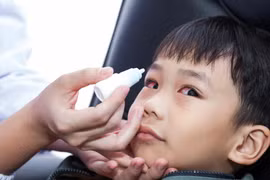 Triệu chứng đau mắt đỏ phổ biến ở trẻ