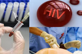 Gallery - Lây nhiễm HIV ở Phú Thọ - image 11
