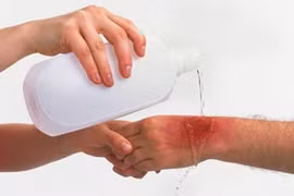 Họng tổn thương trầm trọng khi dùng nước muối quá mặn 