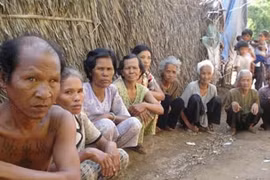 Kỳ lạ ngôi làng có hàng trăm người mù ở Sóc Trăng