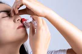 Con vắt chui vào mũi: Xử trí dị vật trong mũi ra sao cho đúng cách?