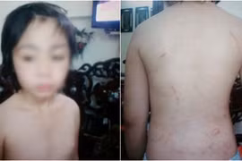 Gallery - Bé trai bị bố đẻ bạo hành - image 4