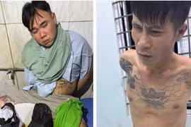 TPHCM: Bắt hai đối tượng cướp giật khiến nạn nhân chấn thương sọ não