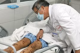 Hà Nội xuất hiện ca viêm màng não mô cầu đầu tiên