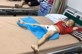 Gallery - Trẻ bị sùi mào gà tại Hưng Yên - image 5