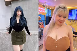 Nữ sinh Hải Dương từng phải phẫu thuật thu nhỏ vòng 1 giờ ra sao?