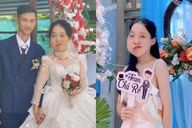 Cô gái mặt lệch từng bị chê ngoại hình, giờ chồng cưng hết mực