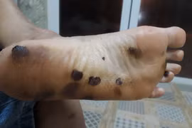 Dầu hắc