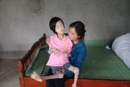 Phú Thọ: Xót thương cháu bé nghèo bị đa dị tật chân tay co quắp
