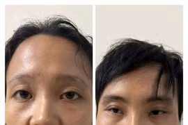 Chân dung cặp vợ chồng bạo hành bé trai 6 tuổi bằng nước sôi