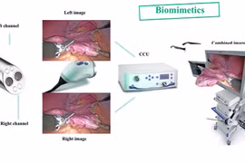 Phẫu thuật nội soi 3D lần đầu tiên tại Việt Nam
