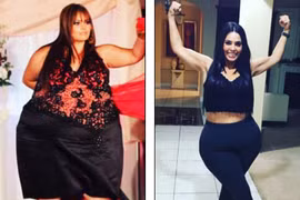 Gái trẻ trở thành người mẫu được săn đón nhờ giảm 100kg