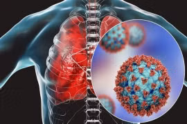 Virus HMPV gây viêm phổi đang lây lan ở Trung Quốc nguy hiểm thế nào?