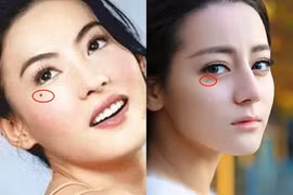 10 nốt ruồi lận đận: Ai có một đời xui xẻo, dễ tai ương