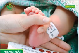 Hội chứng suy giảm miễn dịch tổ hợp SCID