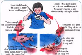 Gan to do sán lá gan nhỏ