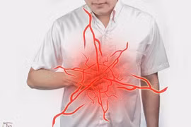 Cảnh giác với cơn đau vùng thượng vị 