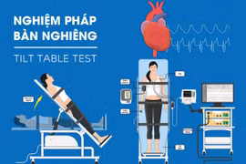Nghiệm pháp bàn nghiêng khi ngất