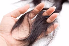 Làm gì khi bị rụng tóc do Covid-19?