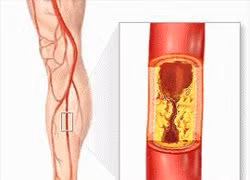 Tự nhiên chân trắng nhợt và tê cứng