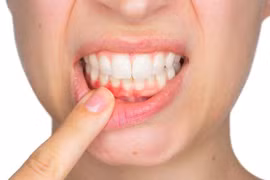 Tụt lợi là tình trạng gì? Có nguy hiểm không?