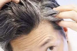 Cơ chế hình thành tóc bạc