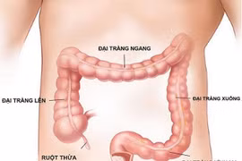 Nội soi tiêu hóa dưới ánh sáng NBI 