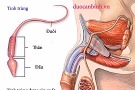 Vô tinh trùng do vi đứt đoạn NST Y