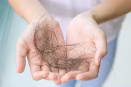 Rụng tóc do điều trị hóa chất nên ứng phó thế nào? 
