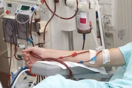 Lọc máu chu kỳ không duy trì chức năng thận